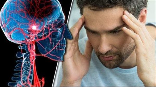  انتبه إليها.. 4 علامات تكشف إصابتك بسكتة دماغية صغيرة