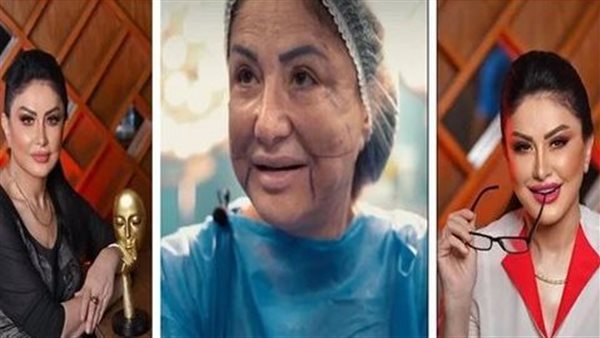 بعد تعرضها لخطأ طبى شوه وجهها..وفاء سالم فى إطلالة عشرينية عقب العملية | شاهد