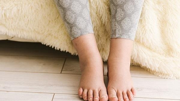 احذر.. قد يشير هذا الأمر في قدميك إلى مرض خطير غير قابل للعلاج