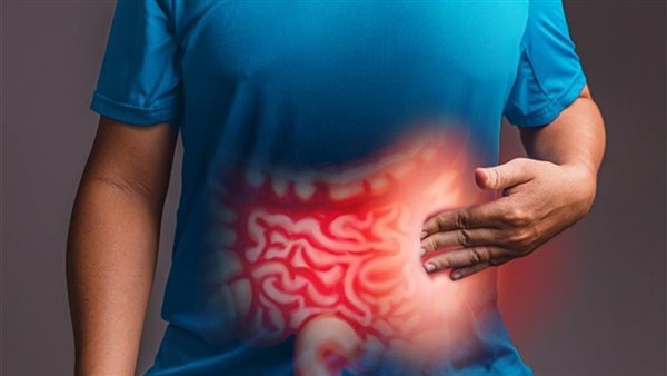  طبيب يكشف سر خفي وراء أكثر حالات القولون العصبي شيوعا