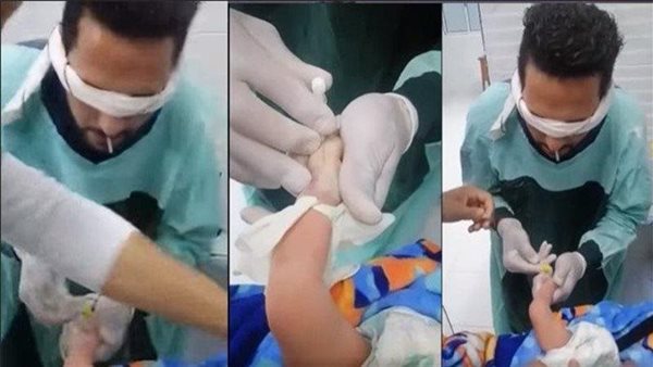  فيديو صادم.. ممرض معصوب العينين يركب كانيولا لرضيع وتحرك عاجل من الصحة | شاهد