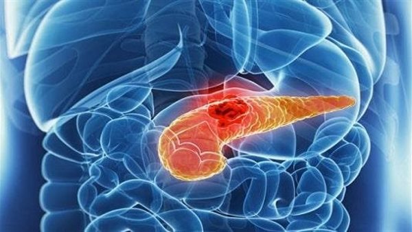 احذر منها..8 أعراض للإصابة بسرطان البنكرياس