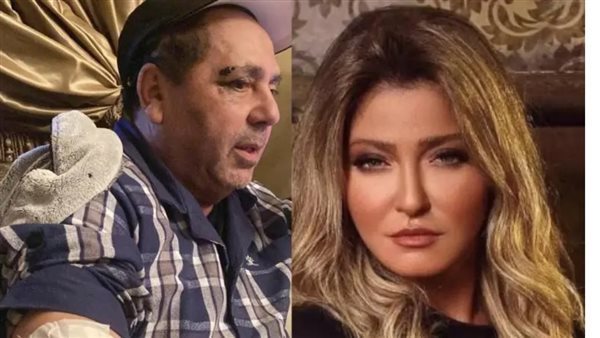 وشه بايظ وحاجبه مفتوح.. أول صور لزوج علا غانم بعد تعرضه للضرب | شاهد