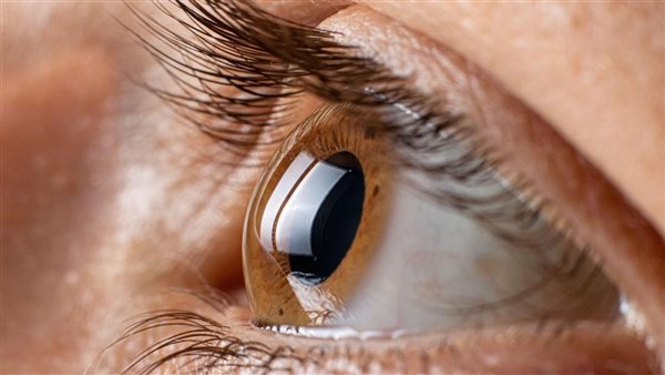 علامة تحذير.. ظهور هلال في عين الإنسان يشير إلى هذا المرض