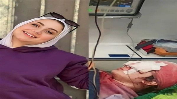 فقدت بصرها في الحال.. من هي البلوجر سارة محمد وماذا حدث لها؟