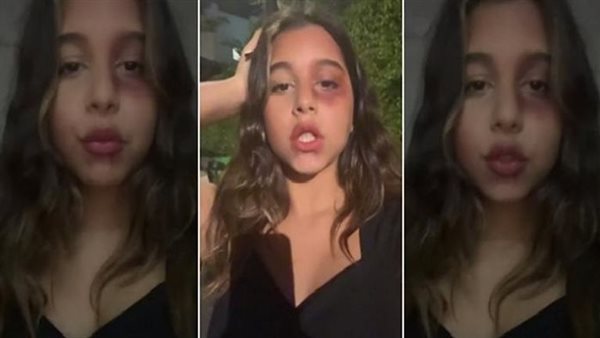 ماما سايباكي كده ليه.. مقطع صادم لابنة شيرين عبدالوهاب بملابس مثيرة | شاهد