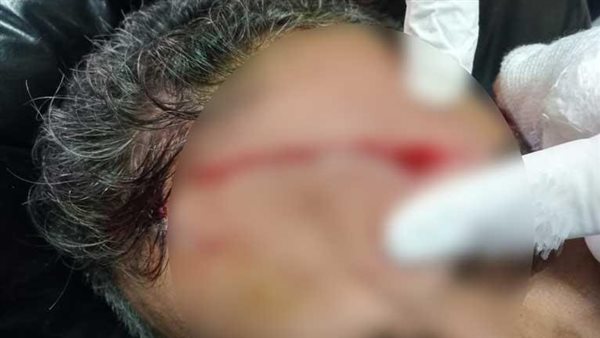 صراخ داخل قسم الحضانات.. أول تعليق من الطبيب المعتدى عليه بمستشفى كفر الزيات