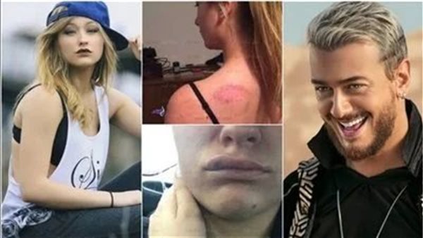 هذا ما فعله معها بالغرفة.. أول تعليق من الفتاة الفرنسية بعد سجن سعد لمجرد بتهمة الإغتصاب