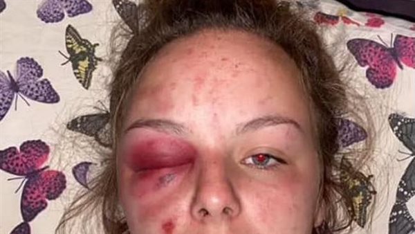 حيلة شيطانية.. كيف برأ فيديو 3 أشخاص من اغتصاب فتاة؟ | شاهد