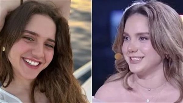 صورة صادمة.. هل خضعت رنا رئيس لعملية تجميل بالأنف؟ | شاهد