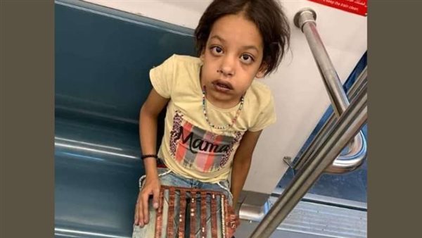 حالتها صعبة.. جمال شعبان يكشف الحالة الصحية لفتاة مترو حلوان | فيديو