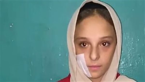 الأم ضربتها والابن شوه وجهها.. تفاصيل مثيرة في الاعتداء على فتاة المرج