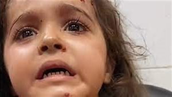 قصفوا أمي وقصفوني.. فيديو مبكي لطفلة من غزة بعد استشهاد والديها | شاهد