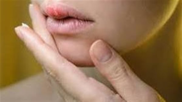 احذرها..علامات مفاجئة في الشفاه تكشف عن هذا النوع الخطير من السرطان 