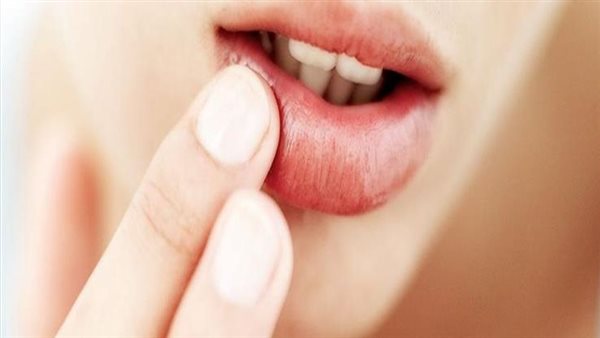 احذرها..علامات إذا ظهرت على شفتيك دليل على الإصابة بهذا المرض
