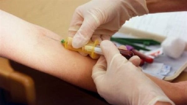 اعرف السر.. لماذا تختفى عروق بعض الأشخاص عند سحب الدم؟ 