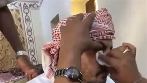  بالفهلوة..مقطع فيديو يثير الجدل بالسعودية لمحاولة إخراج «حجر» من عين مريض دون جراحة | شاهد