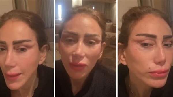 وشها مفتوح.. مقطع فيديو صادم لـ ريهام سعيد من داخل غرفة العمليات | شاهد