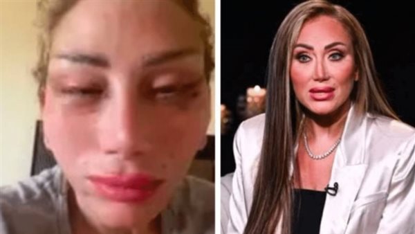 فيديو صادم من العمليات.. ريهام سعيد تفجر مفاجأة جديدة بعد تشويه وجهها | شاهد