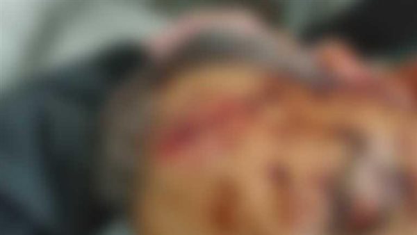 النسايب وقعوا في بعض.. معركة بالشوم والسلاح بسبب خلاف على وزن خاتم ذهب بالفيوم