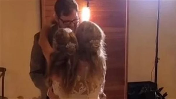 لأول مرة.. زواج توأم ملتصق يثير حالة من الجدل في العالم | شاهد