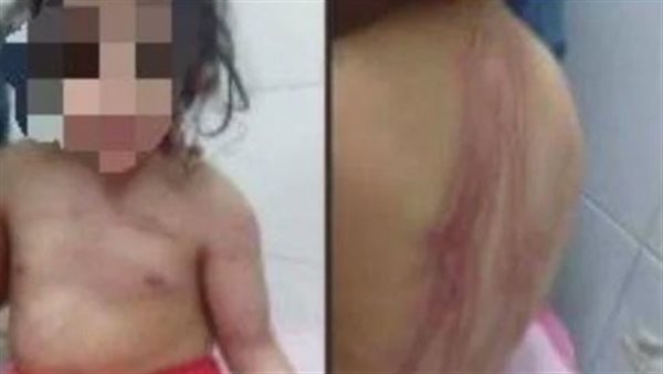  أمها مدمنة.. القصة الكاملة لمأساة طفلة الوراق