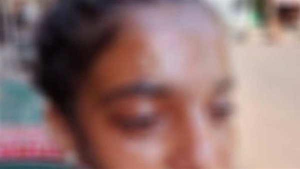 رمت عليها مياه مغلية..التفاصيل الكاملة لواقعة تشويه وجه طالبة داخل مدرسة بالعمرانية