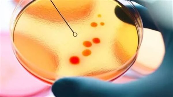 يحول الجلد للون الأصفر.. منظمة الصحة العالمية تحذر من فيروس خطير