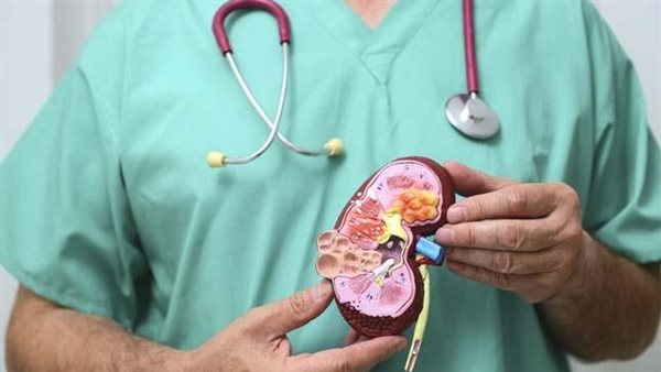  كيف تحمي نفسك منه؟.. علامات خفية تدل على الإصابة بسرطان الكلى