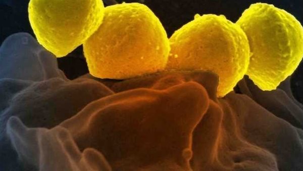 نادرة ومميتة.. كل ما تريد معرفته عن بكتيريا آكلة اللحم