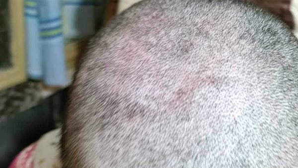 فتاة تستغيث: صاحبتي هتروح مني أهلها عذبوها وحلقوا شعرها | مشاهد صادمة