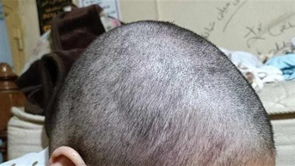 حلقوا لها شعرها علشان الحجاب.. قرار عاجل بشأن واقعة فتاة المقطم