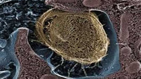 منها تعزيز المناعة.. 3 فوائد عير متوقعة لـ بكتريا الإيكولاي سبب مرض أسوان الغامض