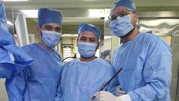 تفاصيل جراحة خطيرة لاستخراج سيخ حديد من عظام حوض طفل بقصر العيني (صور)