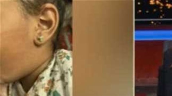 بعد اتهام الأم.. القصة الكاملة لواقعة صفع طفلة داخل حضانة بالإسكندرية | فيديو