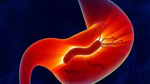  تسبب السرطان.. أعراض الإصابة بجرثومة المعدة وطرق الوقاية منها 