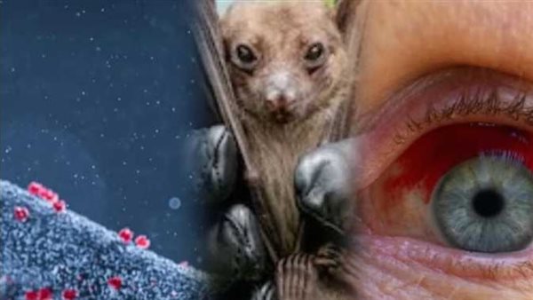 يسيل الدم من العينين والفم.. مخاوف من تفشي فيروسي مرعب بنسب وفيات تصل لـ88%