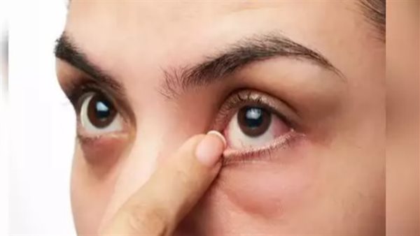  انتبه إليها.. علامة في عينيك تنذر باقتراب إصابتك بسكتة دماغية 