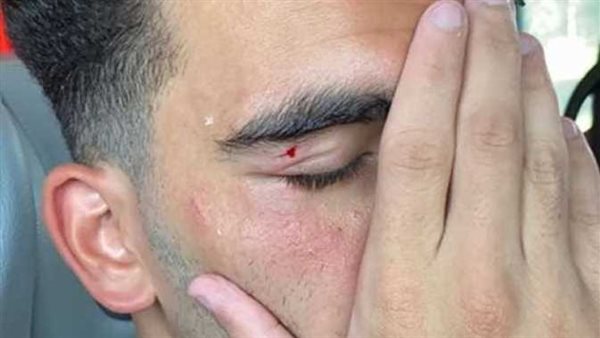 حقيقة الاعتداء على زيزو داخل نادي الزمالك 