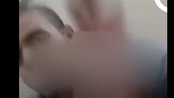 أنا أرجل منك ومش عايزة أعرفك.. فيديو متداول لممرضة تصفع طبيبًا رفض الزواج منها | شاهد