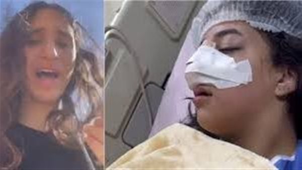  اعوجاج بالأنف.. مفاجأة صادمة بشأن الطالبة كارما ضحية طالبات التجمع الخامس 