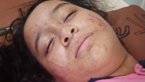 ضربوها وعوروها في وشها لغاية ما أغمى عليها.. ولية أمر وأولادها ينصبون كمينًا لتلميذة في الهرم | شاهد