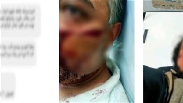  خلاف على الميراث..التفاصيل الكاملة للتعدي على زوجين بالمطرية