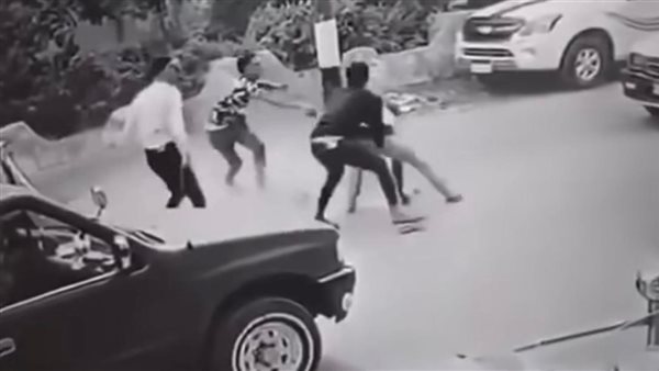 تاخد كام وتسيب القمر.. تطورات الحالة الصحية لمصاب واقعة قطع اليد بالدقهلية