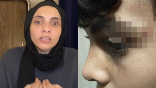 ابني انضرب واتسحل وخايفة أرجع بيتي.. تفاصيل مثيرة جديدة عن خناقة المحمول بمدرسة أكتوبر